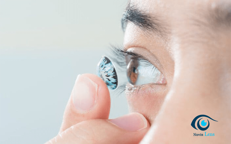 لنز طبی رنگی برای چشم آستیگمات ; novinlens.com